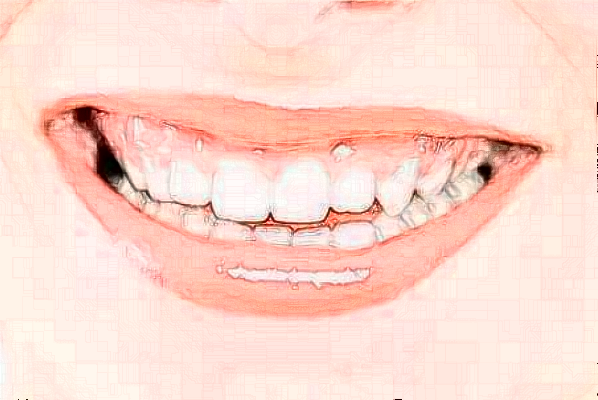 2024安徽醫(yī)科大學(xué)第一附屬醫(yī)院拔牙做的好嗎?哪位醫(yī)生做得好