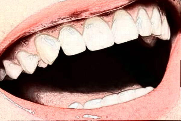 2024齊齊哈爾市中醫(yī)院烤瓷牙怎么樣_誰做得好