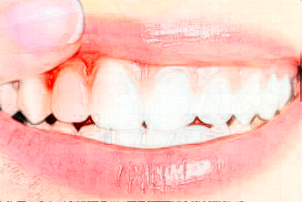 蘇州康美美容醫(yī)院牙齒修復怎么樣_誰做得好