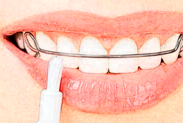 2024徐州醫(yī)科大學(xué)附屬醫(yī)院烤瓷牙多少錢_醫(yī)生名單推薦