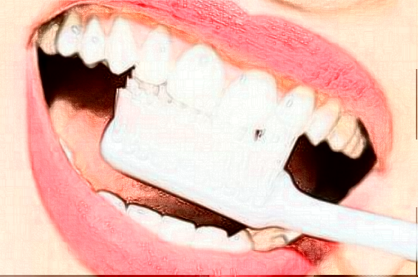 長沙好大夫口腔醫(yī)院種植牙費(fèi)用多少_醫(yī)生名單