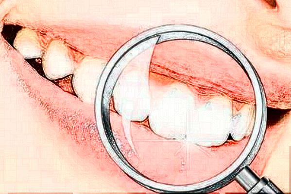 2024株洲市中心醫(yī)院矯正牙齒多少錢?矯正牙齒貴嗎