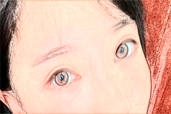 佛山市第二人民醫(yī)院去黑頭怎么樣?2024去黑頭價(jià)格