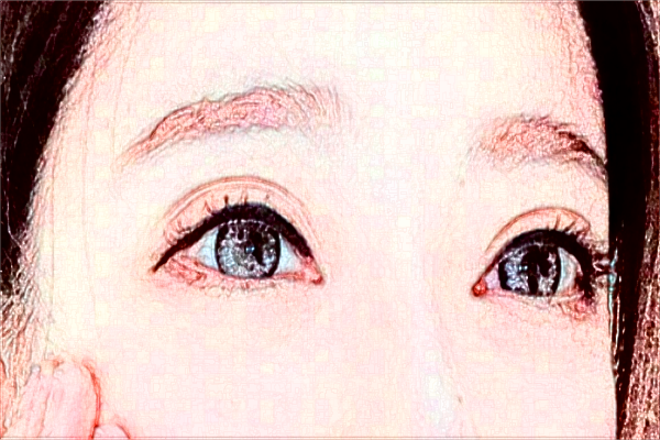 2024懷化市第一人民醫(yī)院飛秒價(jià)格?飛秒激光好不好?