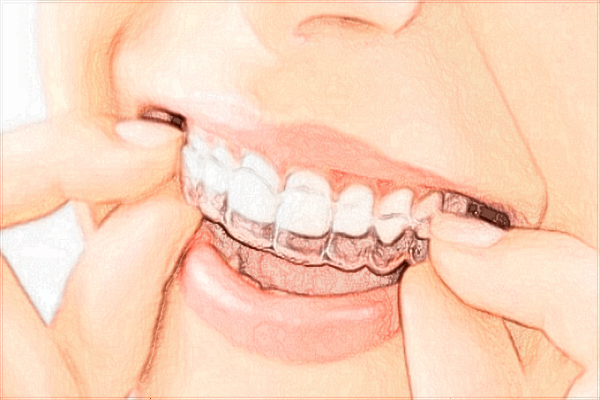 2024海口市人民醫(yī)院牙齒矯正費(fèi)用?牙齒矯正醫(yī)生技術(shù)好嗎