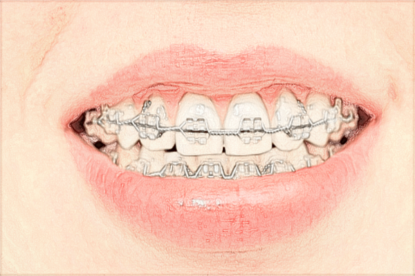 煙臺毓璜頂醫(yī)院口腔科專家好嗎?口腔科常見十大疾病