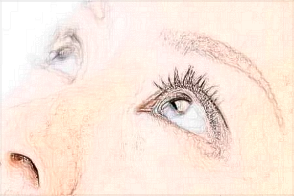 2024常德市第一人民醫(yī)院填淚溝多少錢?填淚溝幾天消腫