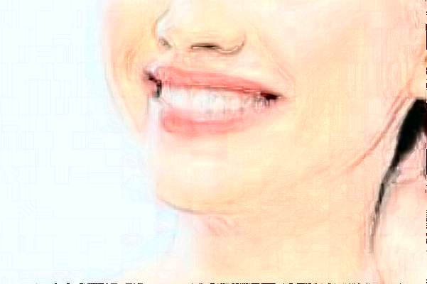 2024長(zhǎng)沙好大夫口腔醫(yī)院鑲牙多少錢?做的怎么樣