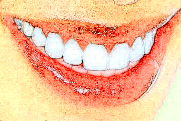 河北大學附屬醫(yī)院全瓷牙怎么樣_案例_價格