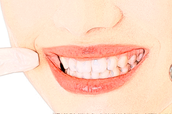 齊齊哈爾市中醫(yī)院全瓷牙怎么樣_誰做得好