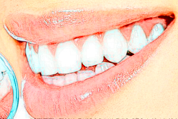 2024河北大學(xué)附屬醫(yī)院種植牙齒費用多少_醫(yī)生名單