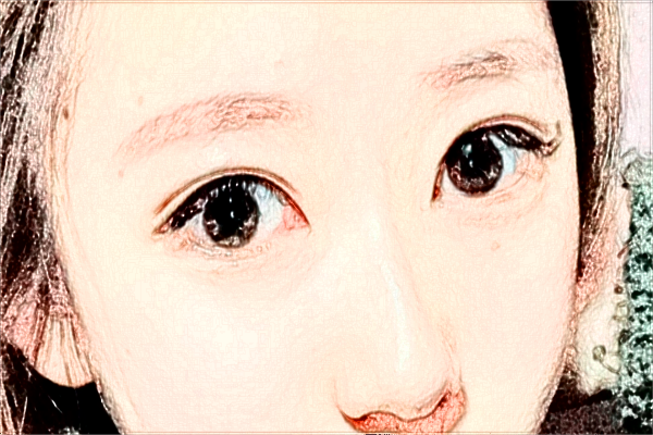 2024海口市人民醫(yī)院飛秒手術(shù)價(jià)格?飛秒手術(shù)后注意事項(xiàng)