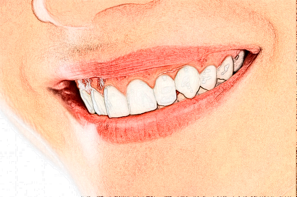 煙臺(tái)毓璜頂醫(yī)院牙科整牙怎么樣?牙科種牙怎么樣?