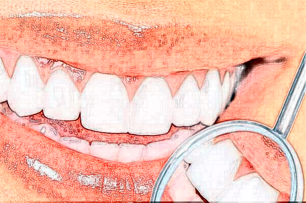 鄭州唯美口腔醫(yī)院全瓷牙整形案例_專家介紹