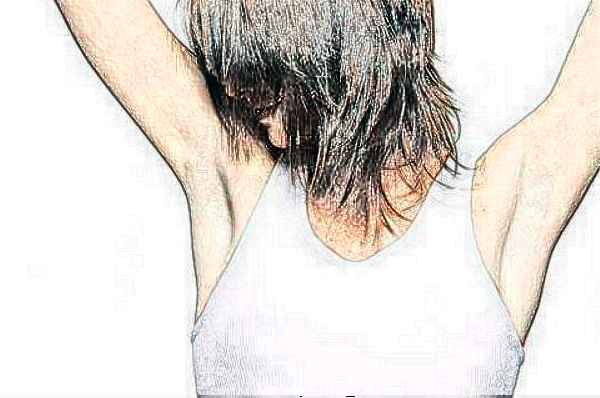 揚州市第一人民醫(yī)院去腋臭做的好嗎?整形日記分享