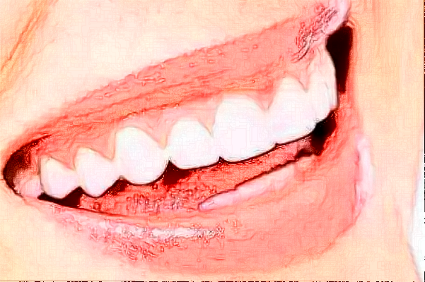 2024安徽醫(yī)科大學(xué)第一附屬醫(yī)院牙套價(jià)格需要多少_真實(shí)案例分享