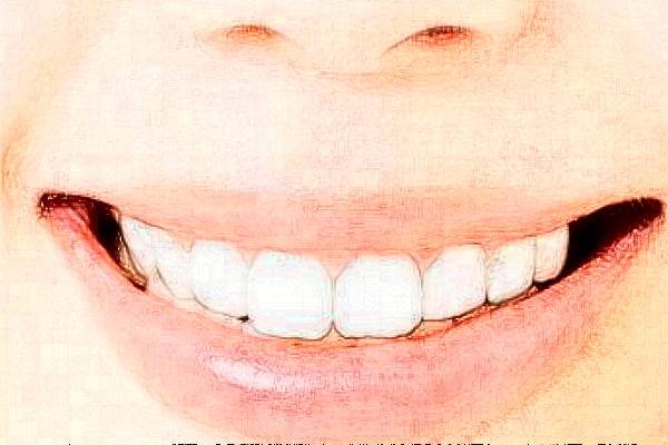 2024安徽醫(yī)科大學(xué)第一附屬醫(yī)院牙套價(jià)格需要多少_真實(shí)案例分享