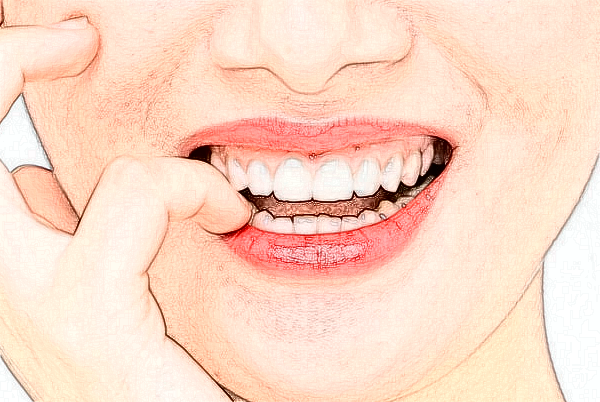 2024無錫市人民醫(yī)院口腔修復(fù)做的好嗎_醫(yī)生推薦