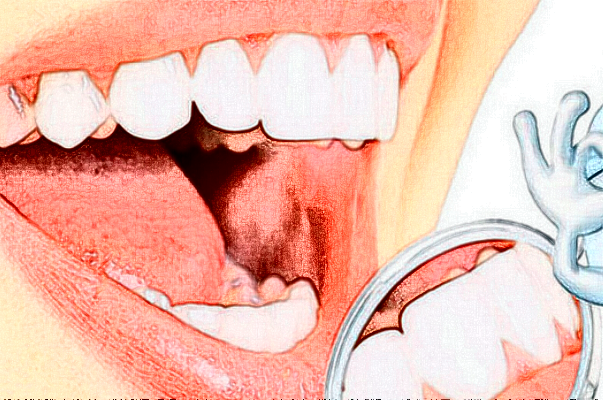 2024無錫市人民醫(yī)院烤瓷牙好嗎?附價格表+案例