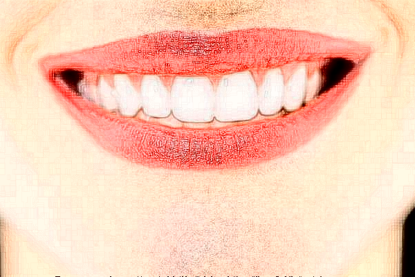 襄陽(yáng)新德恩口腔門診部正畸費(fèi)用多少_真實(shí)案例反饋