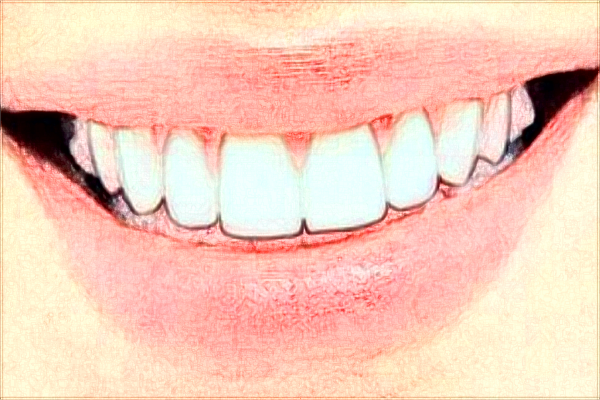 成都新橋口腔醫(yī)院根管疼嗎?根管的注意事項(xiàng)