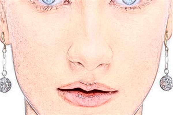 ?？谑腥嗣襻t(yī)院激光點(diǎn)痣好嗎?激光點(diǎn)痣會(huì)留疤嗎