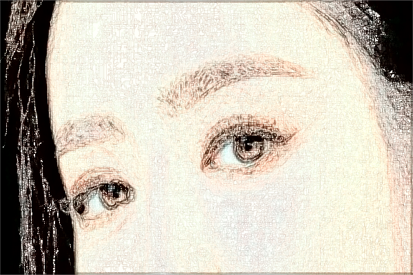 煙臺(tái)中醫(yī)院激光祛斑怎么樣?激光祛斑的副作用