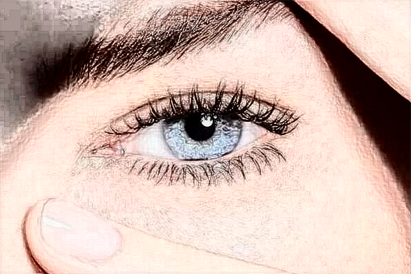 2024煙臺(tái)中醫(yī)院祛斑多少錢(qián)?激光祛斑怎么樣