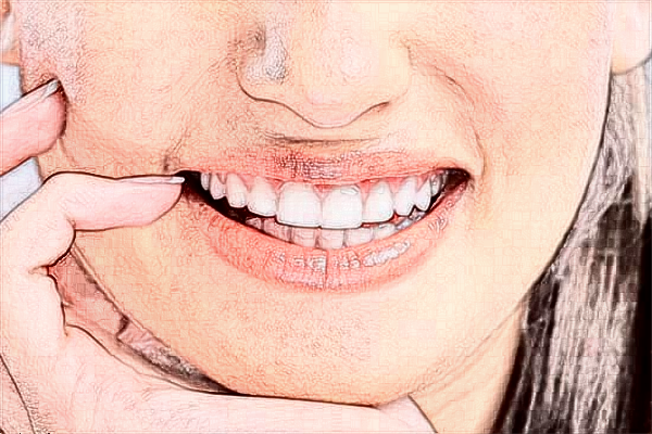 2024青島市立醫(yī)院根管牙齒價(jià)格?根管裂開了怎么辦