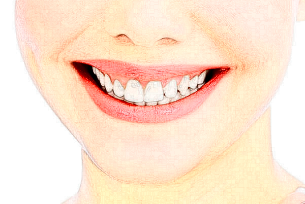 無錫市人民醫(yī)院地包天矯正價位多少?專家介紹