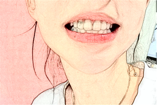 2024蘇北人民醫(yī)院牙齒矯正做的好嗎?誰(shuí)做得好