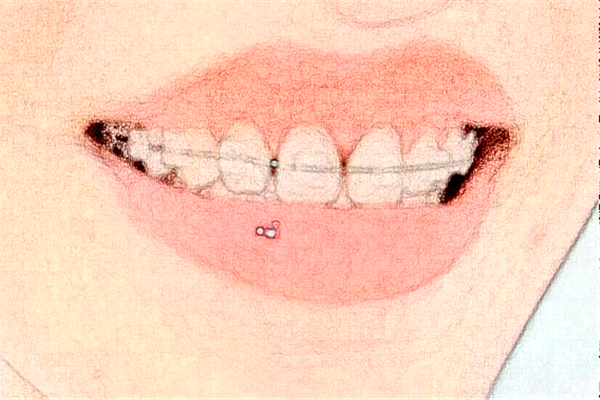 長(zhǎng)沙好大夫口腔醫(yī)院補(bǔ)牙好的大夫?醫(yī)生簡(jiǎn)介