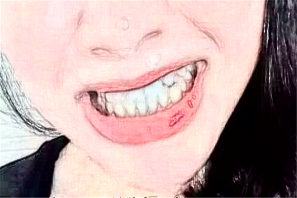 長(zhǎng)沙好大夫口腔醫(yī)院補(bǔ)牙好的大夫?醫(yī)生簡(jiǎn)介