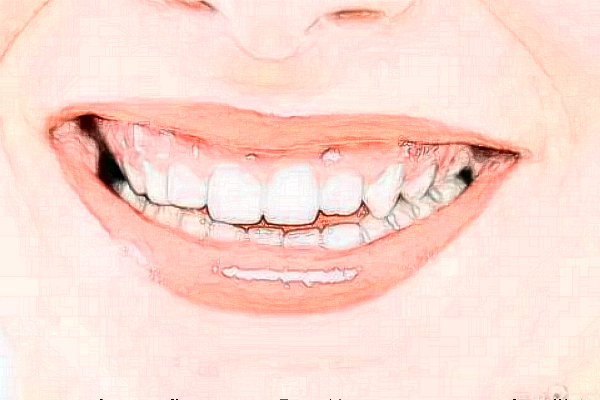 河北大學(xué)附屬醫(yī)院全口種植費(fèi)用多少_醫(yī)生名單