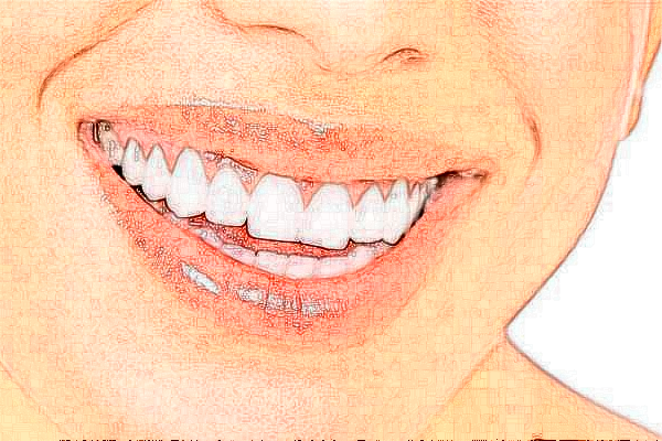 徐州醫(yī)科大學(xué)附屬醫(yī)院牙頜畸形矯正做的好嗎?哪位醫(yī)生做得好