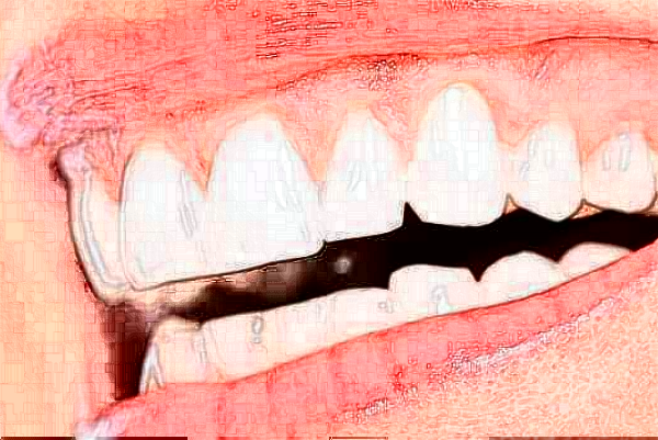 安徽醫(yī)科大學(xué)第一附屬醫(yī)院正畸做的好嗎?哪位醫(yī)生做得好