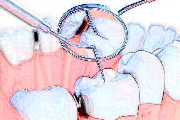 長沙科爾雅口腔醫(yī)院烤瓷牙價格表(價目表)怎么樣