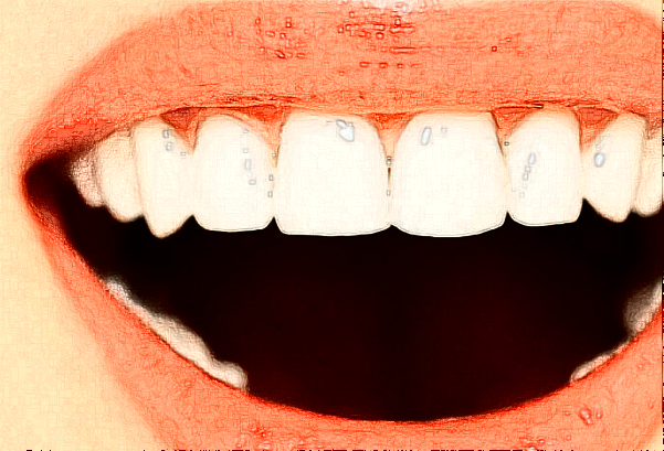 2024無錫市人民醫(yī)院補牙怎么樣【補牙案例】