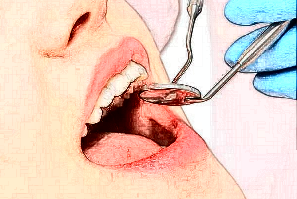 山西省人民醫(yī)院錯(cuò)頜畸形矯正費(fèi)用多少?整形日記全過(guò)程