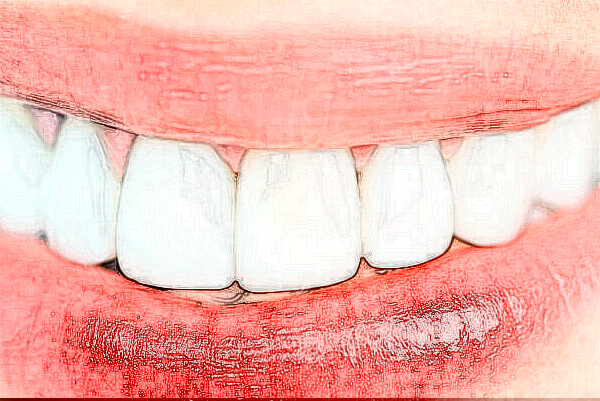 2024銅陵市人民醫(yī)院牙齒美白價(jià)位多少?專(zhuān)家介紹