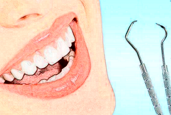 河北大學(xué)附屬醫(yī)院正畸怎么樣|醫(yī)生介紹|價格收費(fèi)