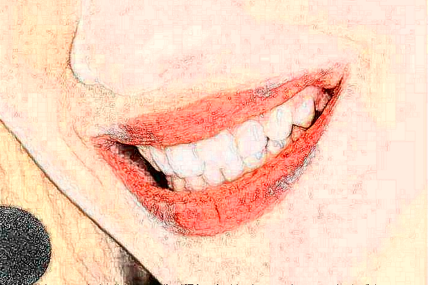 重慶齊美口腔門診部超聲波潔牙怎么樣_專家信息_案例大全欣賞