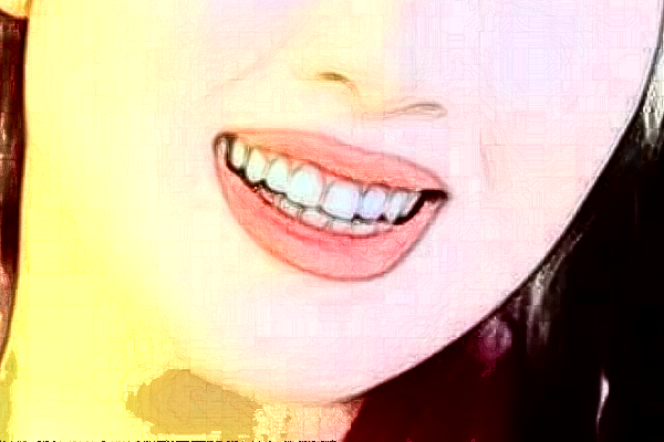 2024貴陽(yáng)柏德口腔醫(yī)院微創(chuàng)種植好的大夫有誰(shuí)?醫(yī)生簡(jiǎn)介