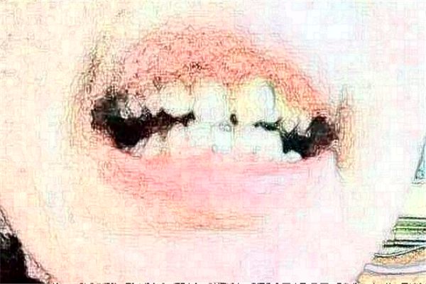 蘇州姑蘇美奧口腔是正規(guī)醫(yī)院?jiǎn)醎地址_收費(fèi)標(biāo)準(zhǔn)