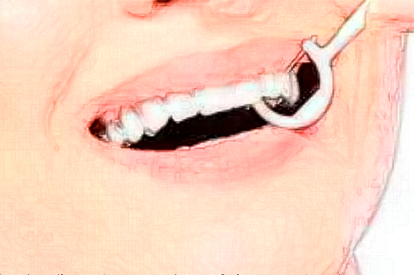 鄭州植得口腔醫(yī)院醫(yī)生名單?哪個醫(yī)生種植牙好