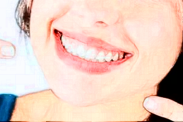 鄭州植得口腔醫(yī)院醫(yī)生名單?哪個醫(yī)生種植牙好