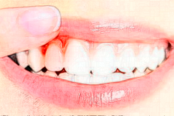 鄭州植得口腔醫(yī)院正畸醫(yī)生好不好?2024正畸醫(yī)生收費價格