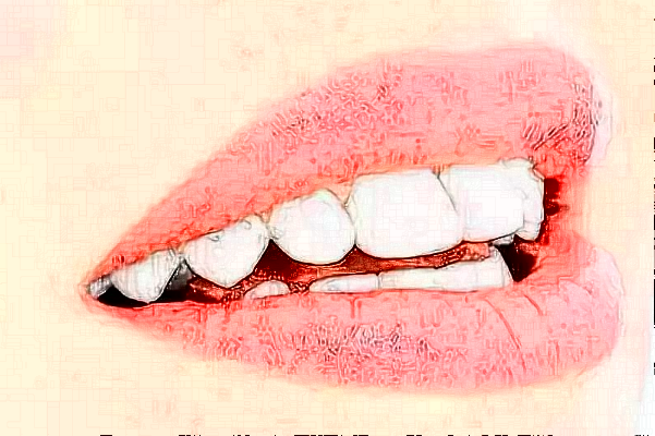 重慶維樂口腔醫(yī)院拔牙如何?拔牙要多久恢復