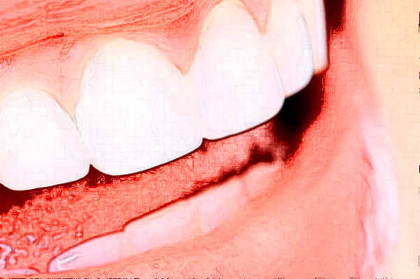 贛州貝殼口腔隱形矯正怎么樣，附醫(yī)生信息一覽~