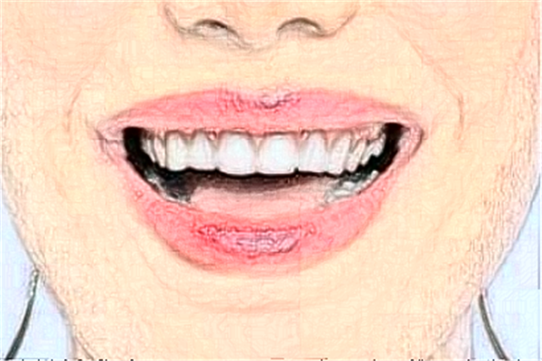 2024重慶齊美口腔門診部補牙怎么樣_專家信息_案例大全欣賞